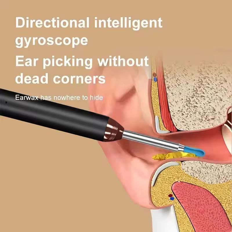 Smart Visual Earwax Cleaner with 1080P HD Camera | WiFi Otoscope with LED Light | Rechargeable Ear Cleaning Tool Kit